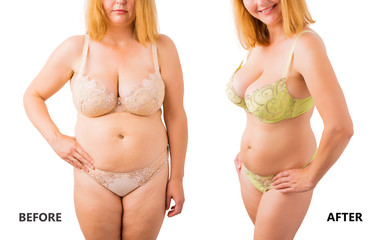 Woman posing in underwear before and after weight loss