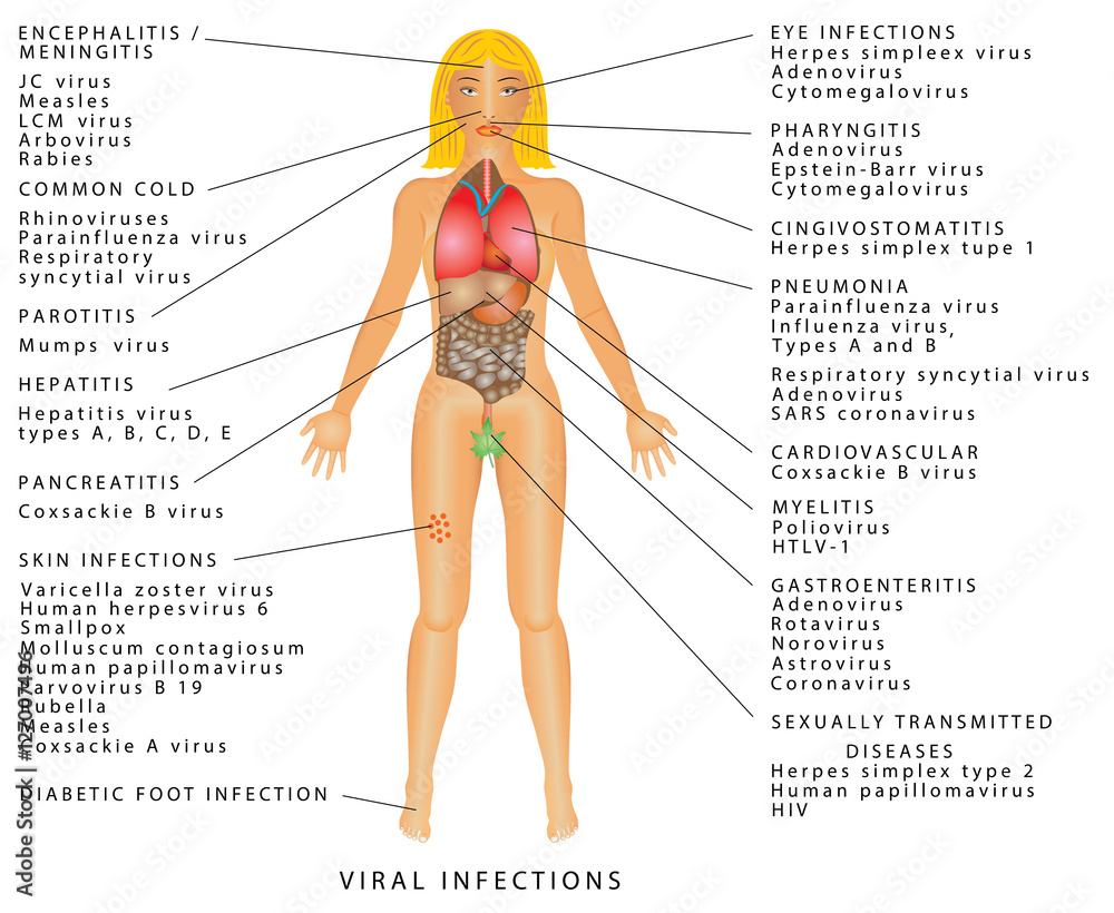 Viral infections. Viral infections - virus diseases. Viral infection ...