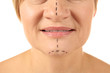 © Africa Studio - Woman with marks on face for plastic operation