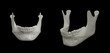 3d rendering illustration of jaw bone