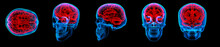 3D Rendering Illustration Of Human Red Brain X Ray Collection