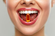 © puhhha - Beautiful Woman Mouth With Pill In Teeth. Girl Taking Vitamins
