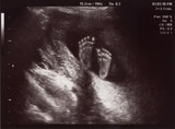Fototapeta Miasta - Ultrasound of In Uterus Baby at 22 weeks. Healthy baby in belly.