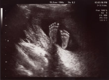 Ultrasound Of In Uterus Baby At 22 Weeks. Healthy Baby In Belly.