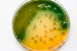Bacterial culture growth on TCBS Agar.
