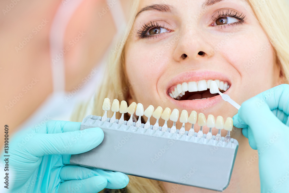 Closeup of a girl with beautiful smile at the dentist. Dental care concept. Whitening - obrazy, fototapety, plakaty 
