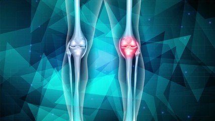 Poster - Knee joint pain beautiful abstract design, geometric figures, lines and glow at the background.