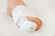 injured toe with bandages