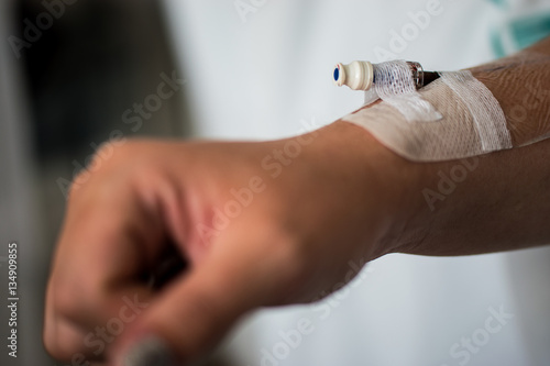 Cannula In Right Arm Of A Caucasian Female Held Down By Tape As A Surgical Aid To Administer 