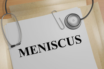 Meniscus - medical concept