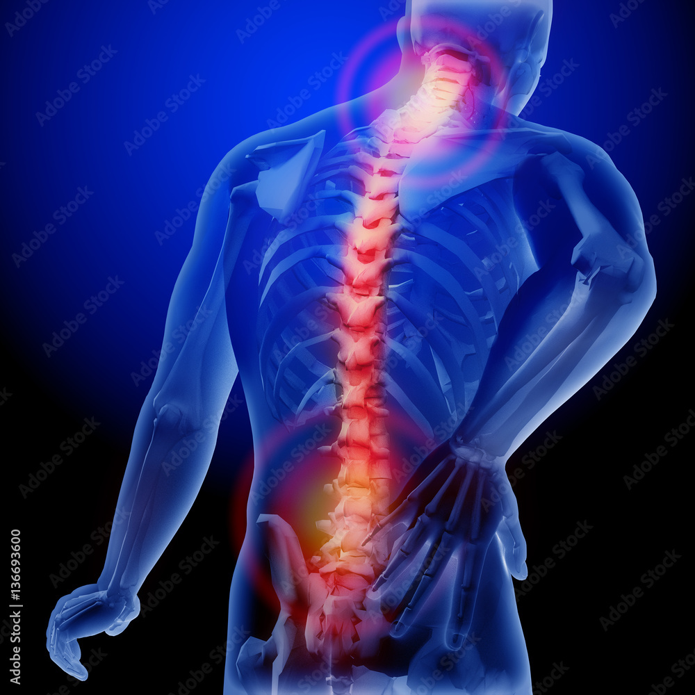 Spine pain. X-ray of the skeleton and body. Anatomical body of a man ...