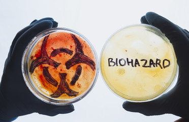 Wall Mural - Hands hold Petri dishes with biohazard word symbol sign. Contaminated water food concept. Dangerous infectious disease. Medical lab testing research. Bacterial infection control prevention outbreak