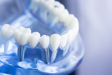 Dental Teeth Dentistry Model