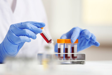 Woman working with blood samples in laboratory, closeup