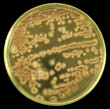 Colonies of pathogenic fungus from air of  biodamaged building on a petri dish (agar plate) manually isolated on a black background. Focus on full depth.