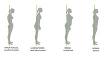 Silhouette Of Women With Correct And Incorrect Posture. Vector Illustration.