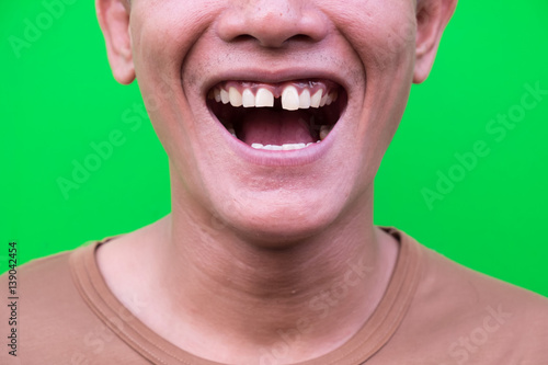 Fotografie, Obraz Asian man smiling showing his teeth unattractive on green background