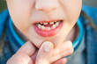 Close up of open mouth of little caucasian child with growing new teeth.