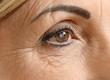 © Africa Studio - Cataract concept. Senior woman's eye, closeup