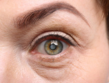 Cataract Concept. Senior Woman's Eye, Closeup