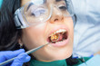 © DenisProduction.com - Dental patient and concave mirror. Teeth of young woman.