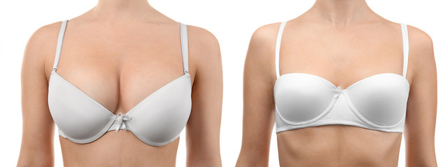 Sticker - Woman before and after breast size correction on white background. Plastic surgery concept