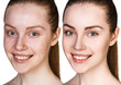Young woman without and with makeup