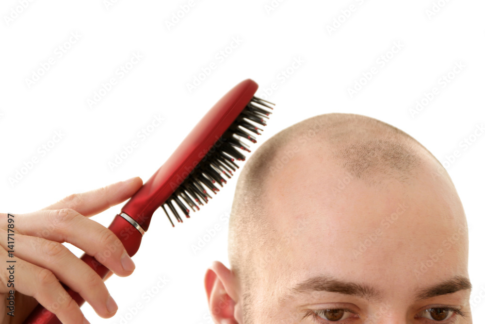 Hair loss concept. Young man with hair comb, closeup