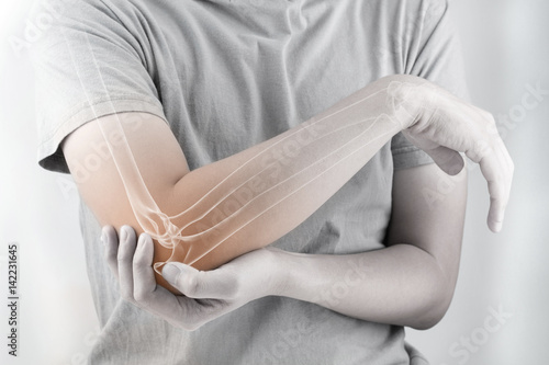 Image of elbow bone. elbow bones injury