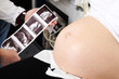 Lekarz ginekolog pokazuje pacjentce zdjęcie usg 