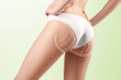 © master1305 - The cellulite removal plan. White markings on young woman body