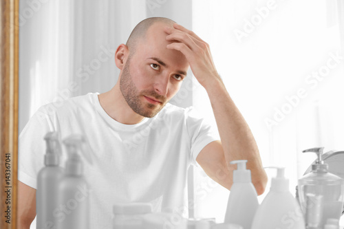 Hair Loss Young Female Hair Loss