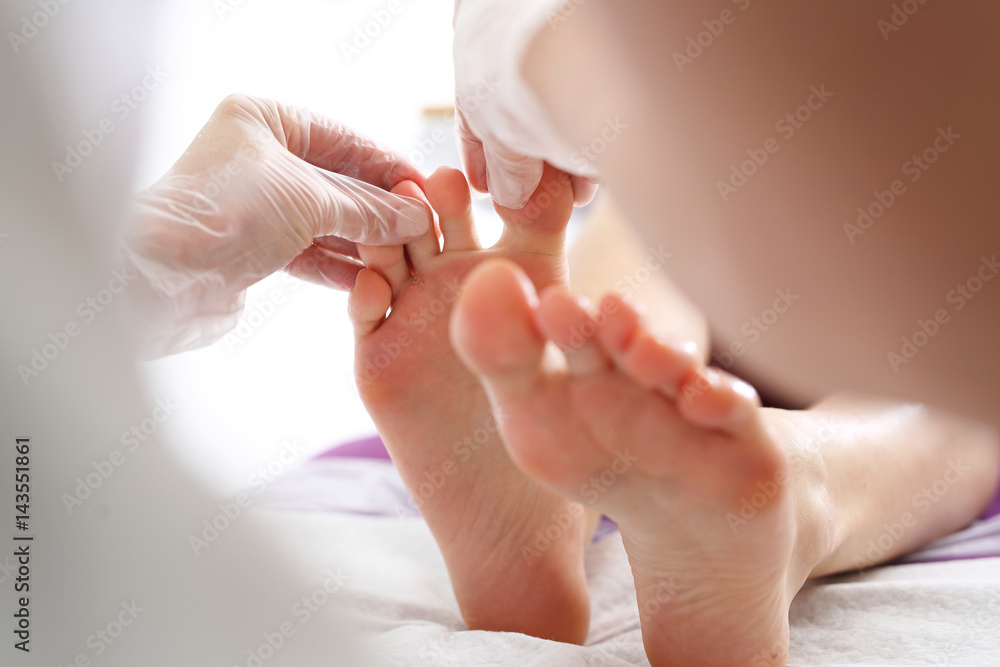 Dermatolog. Lekarz leczy stopy pacjentki - obrazy, fototapety, plakaty 