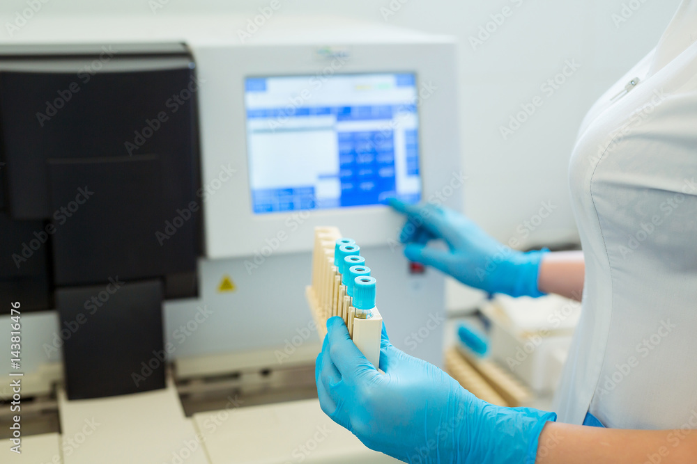 Lab Instruments Coagulation Hands of laboratory assistant loading sample tubes for coagulation test ...
