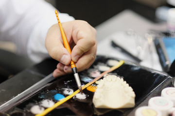 Making an individual tooth crown in a denture laboratory