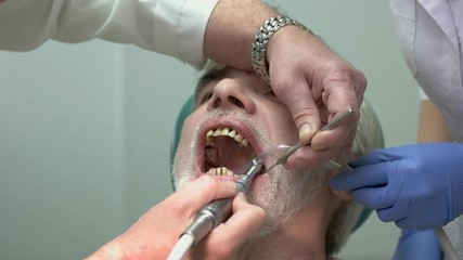 Wall Mural - Dentist is polishing teeth. Elderly patient of stomatologist. Dental enamel erosion.