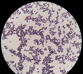 smear of gram positive cocci bacteria under 100x light microscope.