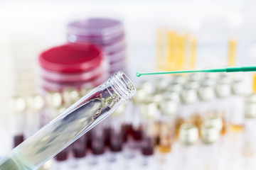 Inoculation of sample in culture medium in tube / Analysis of urine sample in tube for Bacterial growth