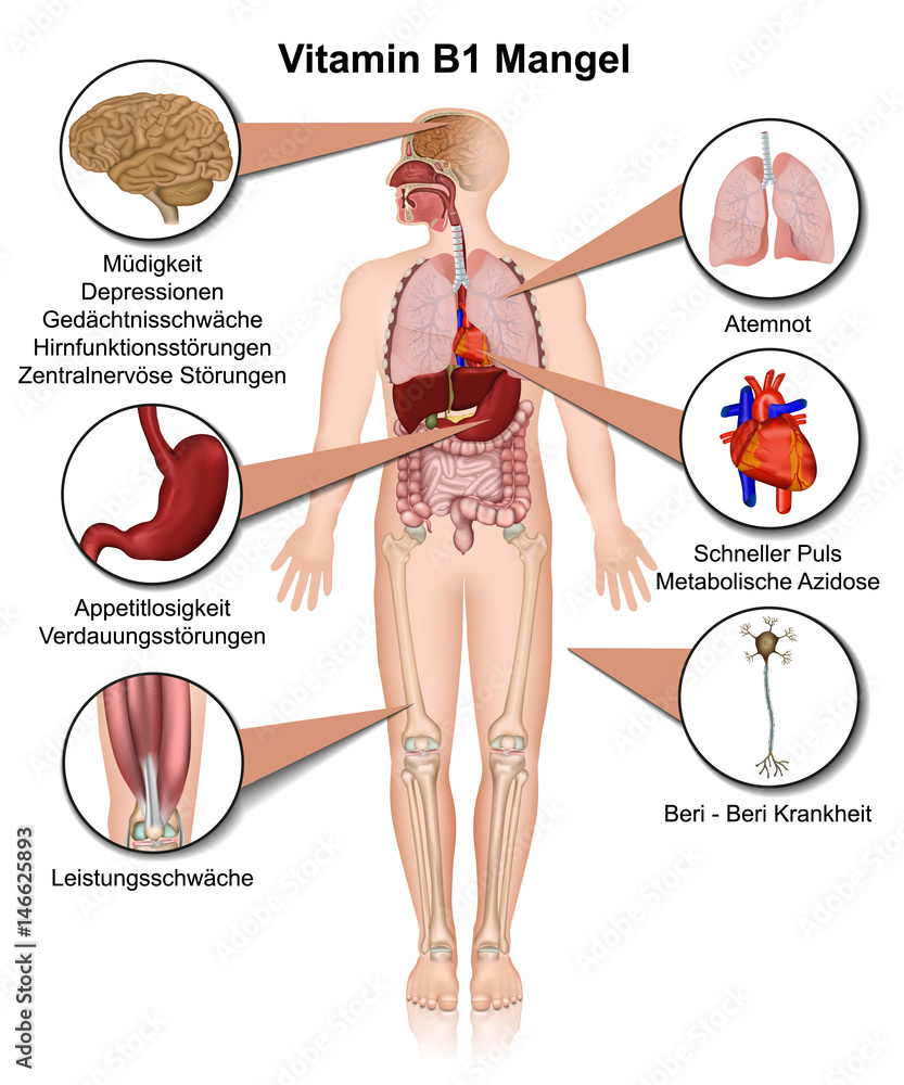 Vitamin B1 Und B6 Mangel Symptome
