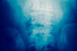 Close up spinal cord bone