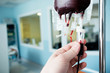 close view of man's hand, checking a doze of blood during hemotransfusion in hospital
