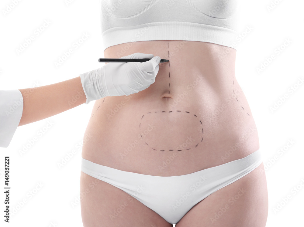 Surgeon hand drawing marks on female body for plastic operation