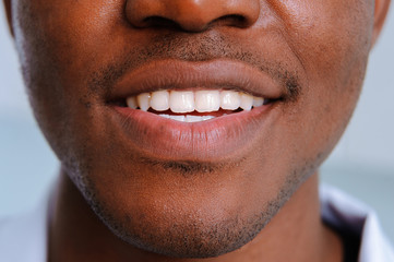 White teeth smile black man close up