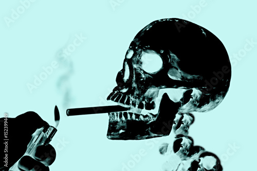 Cuadros en Lienzo Smoking kills or Stop smoking conceptual image with x-ray image