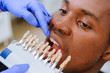 © lisovoy - Check and select the color of the teeth. Dentist makes the process of treatment in dental clinic.