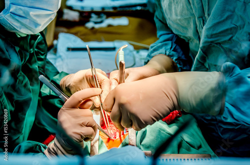 Fotografía The process of performing cardiac surgery by a surgeon and his assistant