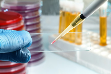 Hand of the lab technician holding a slide and depositing a sample / technician preparing sample in slide for microscope