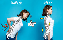 Good Posture And Bad Posture, Woman's Body Silhouette And Backbone, Chiropractic Before After Concept.