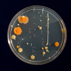 Poster - petri dish samples with bacteria and fungal colonies