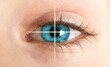 Eye laser therapy